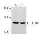 AHRR Antibody (5G11) - Western Blotting - Image 414183 
