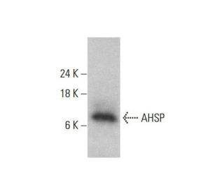 AHSP Antibody (D-12) - Western Blotting - Image 348584 