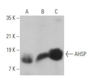 AHSP Antibody (G-5) - Western Blotting - Image 373565 