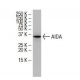 AIDA Antibody (7F6) - Western Blotting - Image 33517 