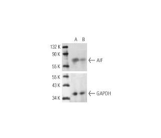 AIF siRNA (m): sc-29194. Western blot analysis of AIF expression in non-transfected control (A) and AIF siRNA transfected 