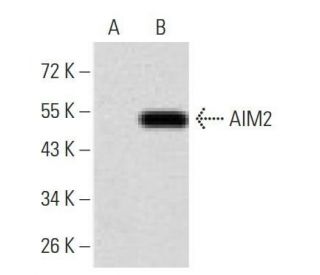 AIM2 Antibody (3C4G11) | SCBT - Santa Cruz Biotechnology