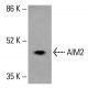 AIM2 Antibody (F-11) - Western Blotting - Image 416065