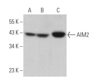 AIM2 Antibody (F-11) - Western Blotting - Image 369856The Double Nickase Plasmid features a U6 promoter for sgRNA expression, a 20 nt targeting sequence, and a gRNA scaffold to guide Cas9n. It includes a CBh promoter for Cas9n (D10A) and puromycin resistance, GFP for transfection verification, and nuclear localization signals (NLS). The 2A peptide allows co-expression of Cas9n and Puro from a single promoter, enabling precise genome editing with reduced off-target effects.