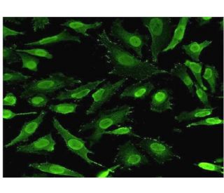 Aiolos Antibody (3H5-G7) - Immunofluorescence - Image 351769 