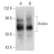 Aiolos Antibody (3H5-G7) - Western Blotting - Image 368037 