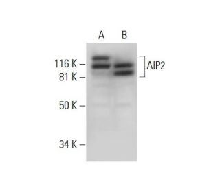 AIP2 Antibody (G-9) - Western Blotting - Image 294657 