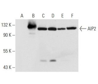 AIP2 Antibody (A-3) - Western Blotting - Image 301289Each CRISPR/Cas9 Knockout (KO) Plasmid product consists of a pool of 3 plasmids designed to ensure identification and cleavage of a specific gene for maximum knockout efficiency. Each plasmid encodes a unique 20 nt sequence derived from the GeCKO (v2) library.