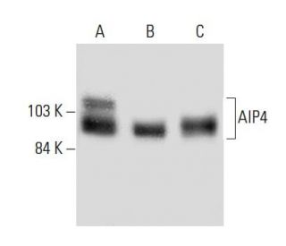 western blotting image from recommended AIP4 (G-11) monoclonal antibody replacement. Image 8962
