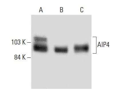 AIP4 Antibody (G-11) | SCBT - Santa Cruz Biotechnology