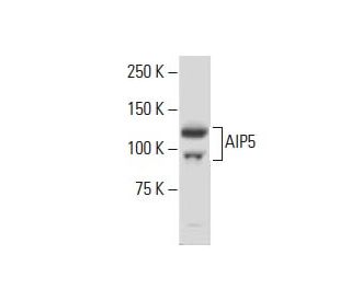 AIP5 Antibody (5AA) - Western Blotting - Image 34051 