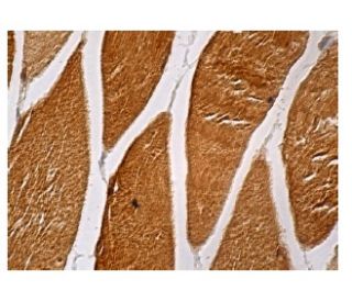 immunohistochemistry image from recommended AK1 (E-8) monoclonal antibody replacement. Image 161029