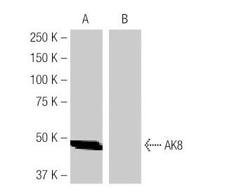AK8 Antibody (4B6) - Western Blotting - Image 64880 