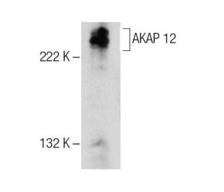 AKAP 12 Antibody (C-12) - Western Blotting - Image 158455The Double Nickase Plasmid features a U6 promoter for sgRNA expression, a 20 nt targeting sequence, and a gRNA scaffold to guide Cas9n. It includes a CBh promoter for Cas9n (D10A) and puromycin resistance, GFP for transfection verification, and nuclear localization signals (NLS). The 2A peptide allows co-expression of Cas9n and Puro from a single promoter, enabling precise genome editing with reduced off-target effects. 