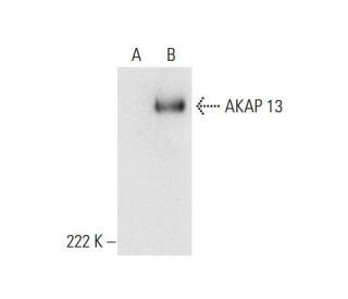 AKAP 13 Antibody (A-3) - Western Blotting - Image 299320