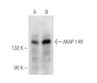 AKAP 149 Antibody (B-10) - Western Blotting - Image 284991 