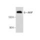 western blotting image from recommended AKAP 150 (E-1) monoclonal antibody replacement. Image 281233