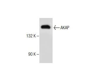 western blotting image from recommended AKAP 150 (E-1) monoclonal antibody replacement. Image 281233