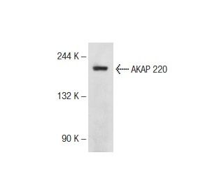 AKAP 220 Antibody (13) - Western Blotting - Image 145817 