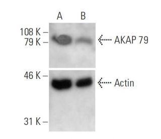 AKAP 79 siRNA (h): sc-29660. Western blot analysis of AKAP 79 expression in non-transfected control (A) and AKAP 79 siRNA 