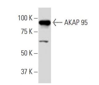 AKAP 95 Antibody (22-Z) - Western Blotting - Image 34013 