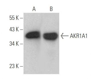 AKR1A1 Antibody (B-10) - Western Blotting - Image 372074 