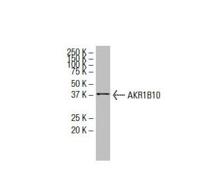 AKR1B10 Antibody (AA-1) - Western Blotting - Image 33872 