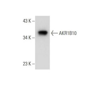 AKR1B10 Antibody (D-8) - Western Blotting - Image 294646 