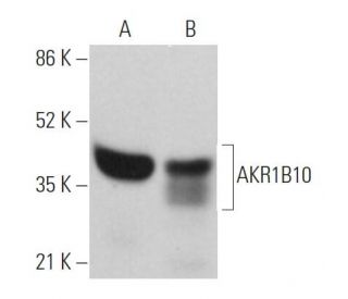 AKR1B10 Antibody (F-4) - Western Blotting - Image 362481 