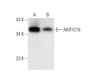 AKR1C19 Antibody (A-1) - Western Blotting - Image 297033