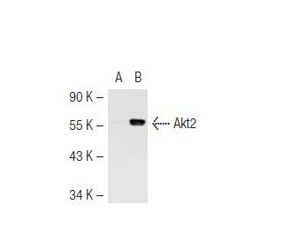 Akt2 Antibody (8B7) - Western Blotting - Image 44806 
