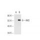 Akt2 Antibody (8B7) - Western Blotting - Image 44806 