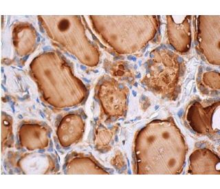 immunohistochemistry image from recommended Akt2 (F-7) monoclonal antibody replacement. Image 353771