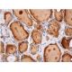immunohistochemistry image from recommended Akt2 (F-7) monoclonal antibody replacement. Image 353771