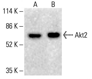 Akt2 Antibody (1G8C12) - Western Blotting - Image 412698