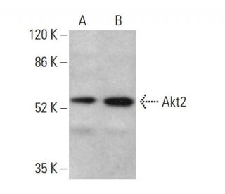 Akt2 Antibody (F-7) - Western Blotting - Image 377614SAM Transcription Activation: SAM system utilizing dCas9-VP64, MS2-P65-HSF1, and sgRNA for precise gene transcription activation.