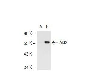 Akt2 Antibody (8B7) - Western Blotting - Image 44806