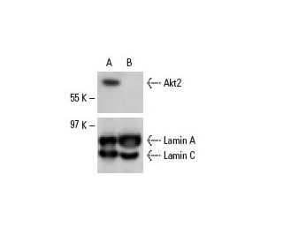 Akt2 siRNA (h): sc-29197. Western blot analysis of Akt2 expression in non-transfected control (A) and Akt2 siRNA transfect 