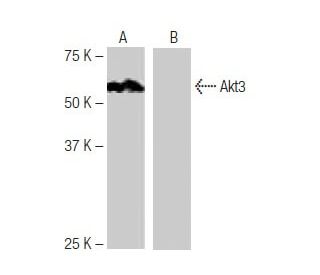 Akt3 Antibody (EE-M14) - Western Blotting - Image 64833 