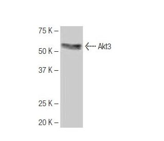 Akt3 Antibody (EE-M14) - Western Blotting - Image 64834 