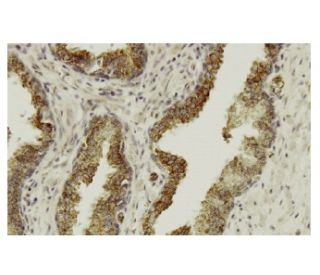 Aladin Antibody (3E9) - Immunohistochemistry - Image 35972 