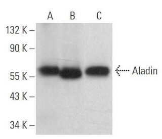 Aladin Antibody (B-11): sc-374073