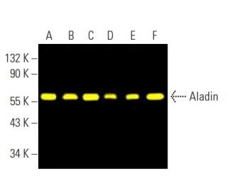 Aladin Antibody (B-11) - Western Blotting - Image 396464 