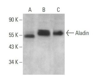 Aladin Antibody (G-12) - Western Blotting - Image 359114 