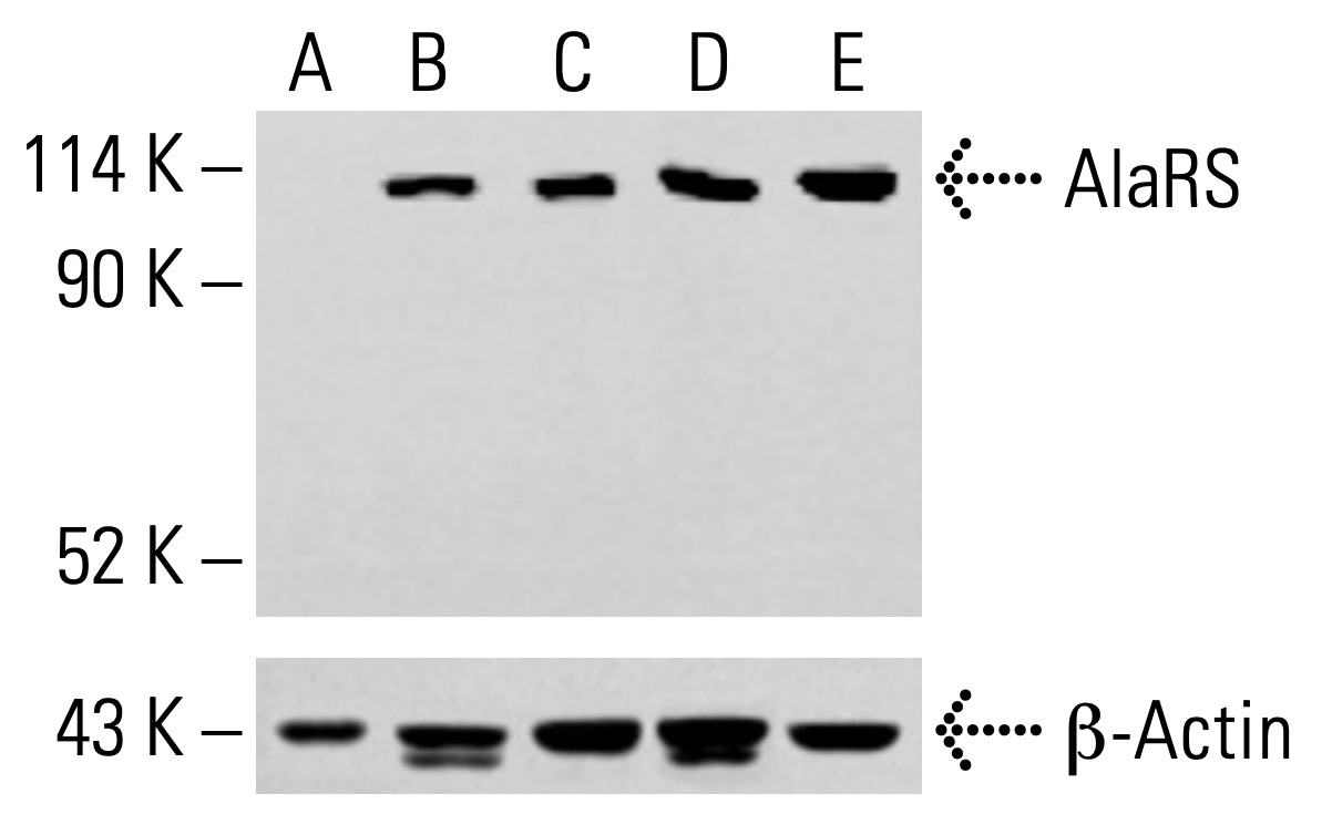 AlaRS Antibody (A-6) | SCBT - Santa Cruz Biotechnology