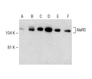 AlaRS Antibody (M6-P2E5) - Western Blotting - Image 150480 