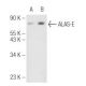 ALAS-E Antibody (D-4) - Western Blotting - Image 99712