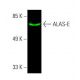 ALAS-E Antibody (D-4) - Western Blotting - Image 387649 