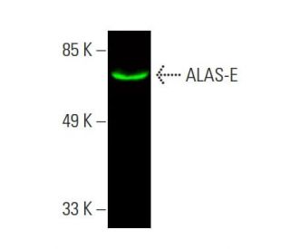 ALAS-E Antibody (D-4) - Western Blotting - Image 387649 
