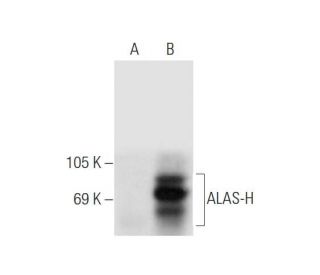 ALAS-H Antibody (C-6) - Western Blotting - Image 57517 